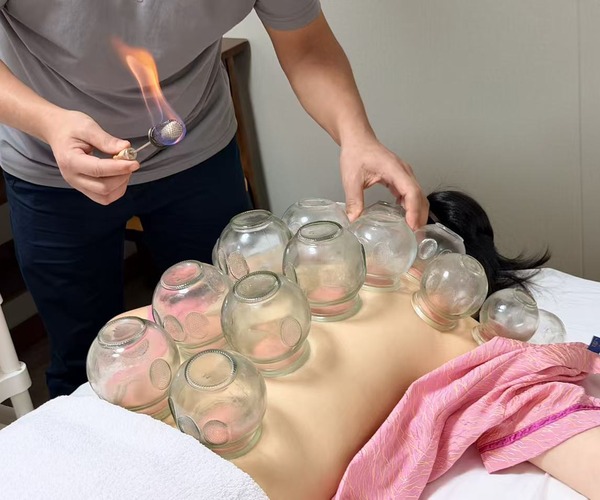 Cupping clinic / 诊室